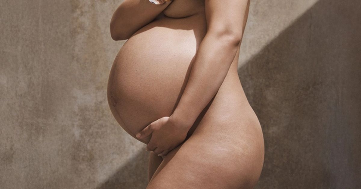 Stretch marks: how to prevent them or fade their appearance